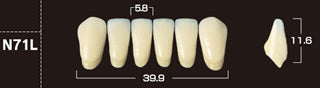 Crown PX Premium 3-Layer Composite Anterior Denture Teeth - Mega Dental Art Supply