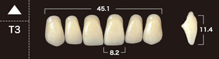 New Ace 2-Layer Acrylic Anterior Denture Teeth - Mega Dental Art Supply