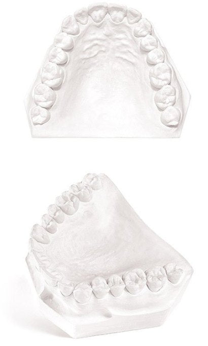Garreco Dental Plaster Type III - Mega Dental Art Supply