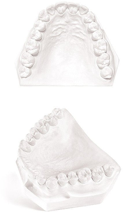 Garreco Flasking Stone Type III - Mega Dental Art Supply