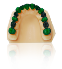 Load image into Gallery viewer, Dental Resin for Dental DLP 3D Printer - Mega Dental Art Supply
